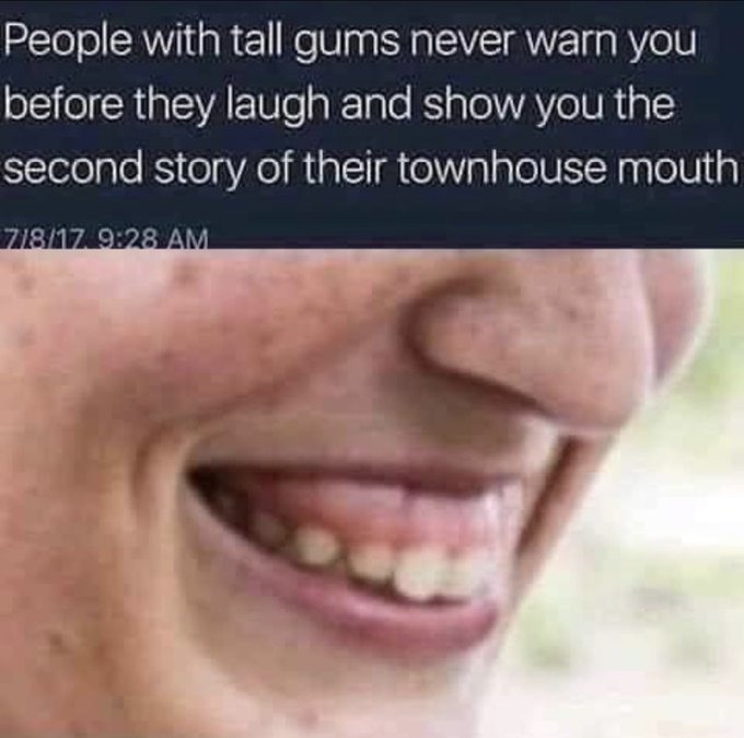 worse if the gums be black – meme