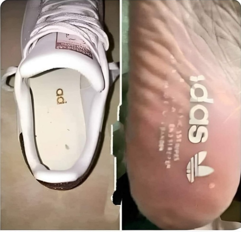 Bootleg adidas – meme