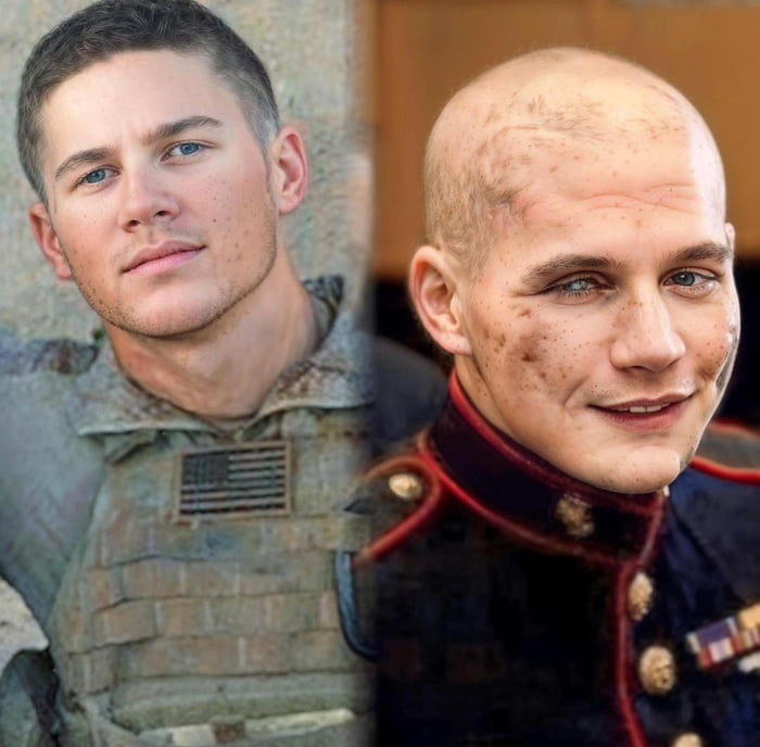 US Marine Lance Corporal William u201cKyleu201d Carpenter, the man who threw himself in front of a grenade in Afghanistan to protect his best friend