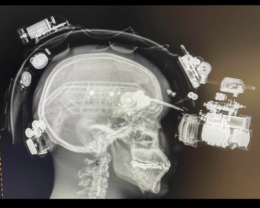 Guy got an x-ray while wearing nvgs (stolen from reddit) – meme