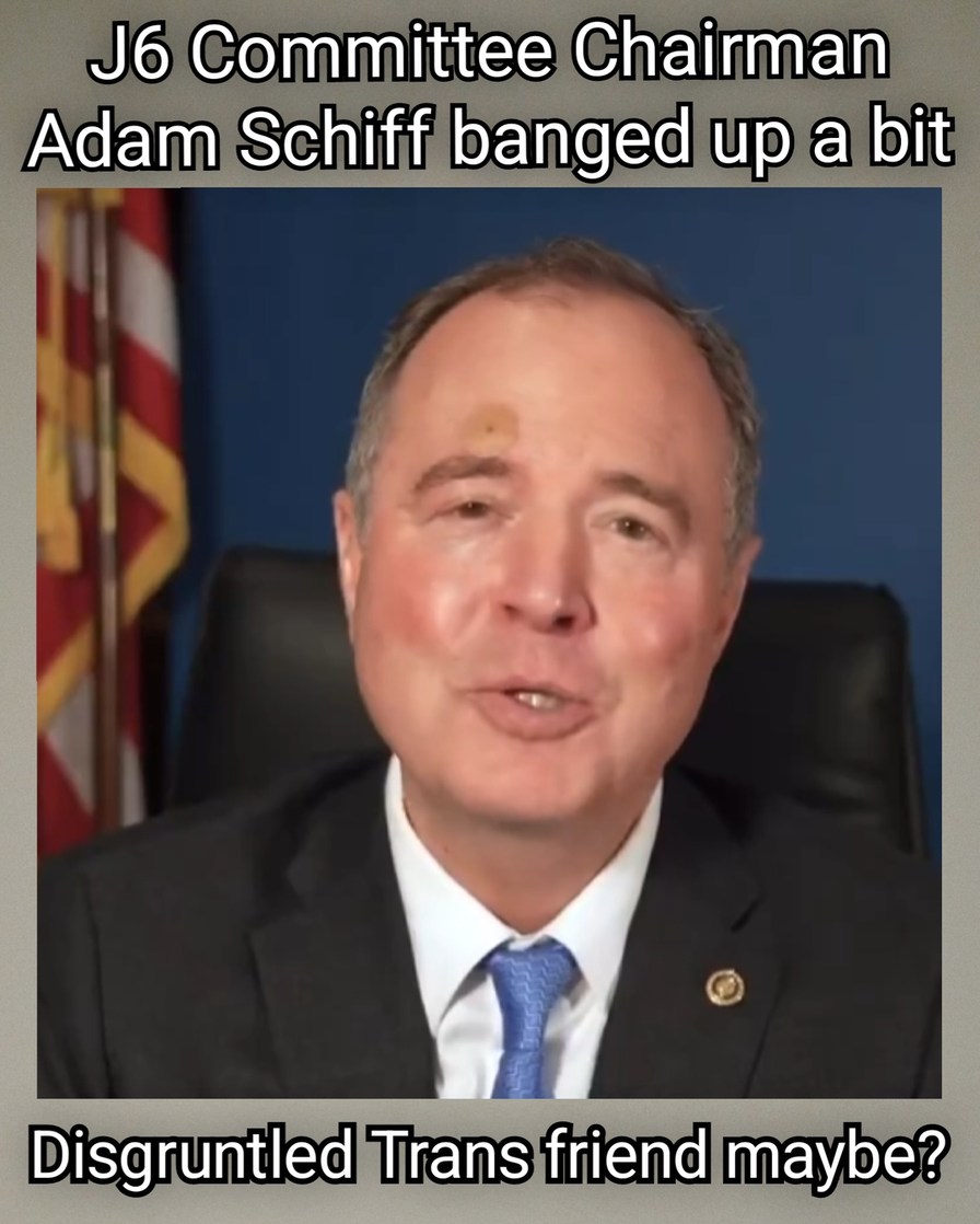 Looks Like He Was Hit With A Baseball Bat – meme